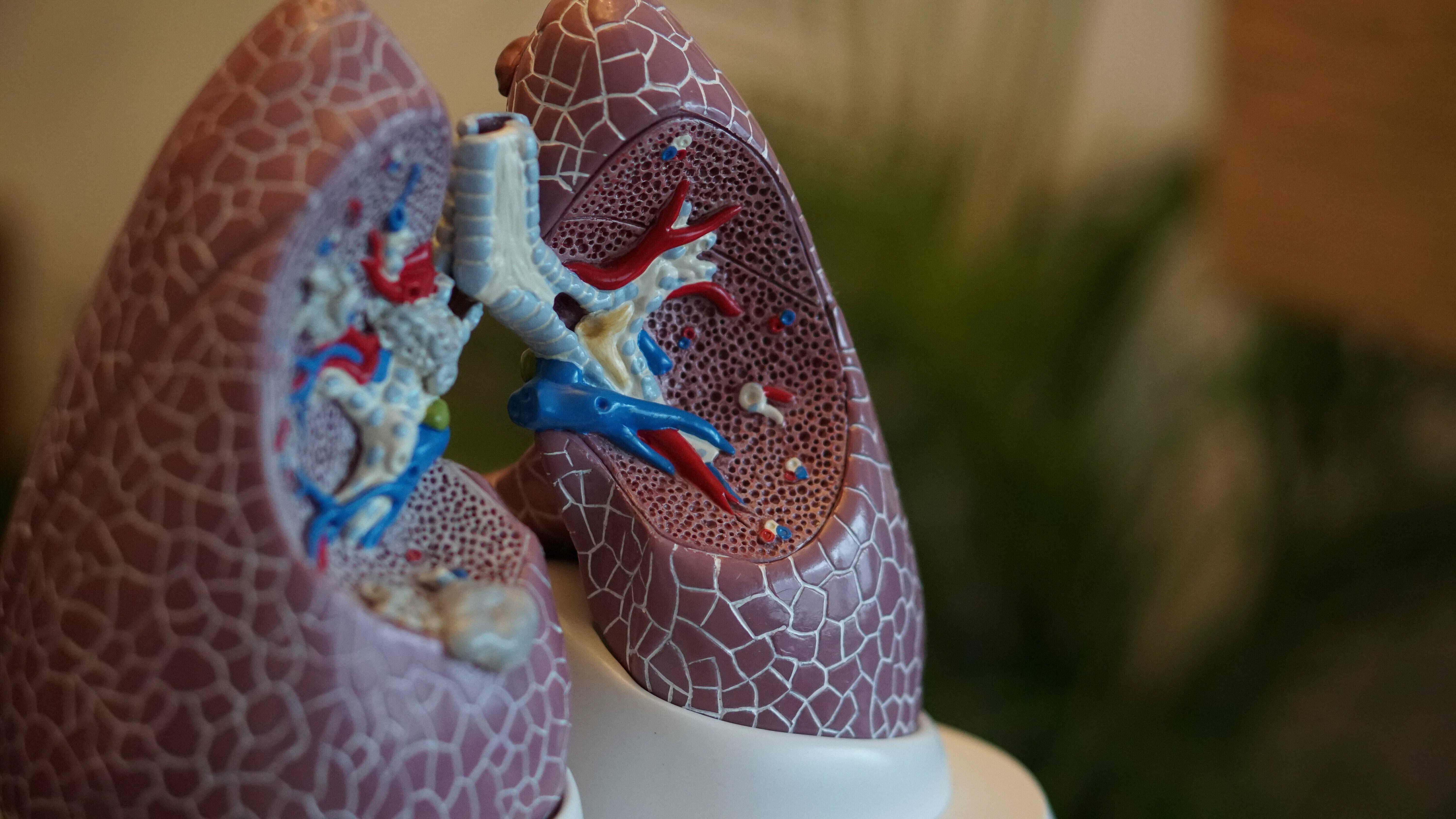 Neue Studie: Rauchstopp verhindert viele Lungenkrebsfälle 
